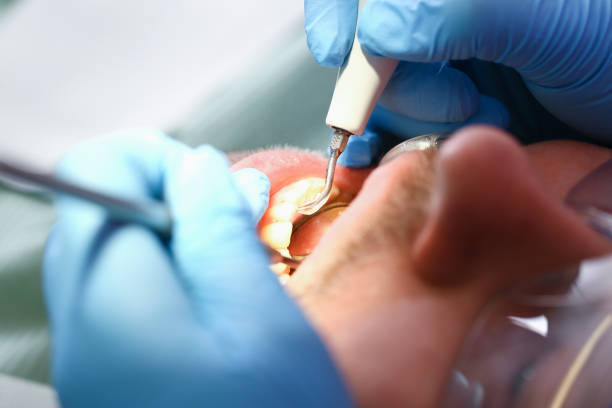 Best Walk-In Emergency Dentist in Sturgeon Bay, WI
